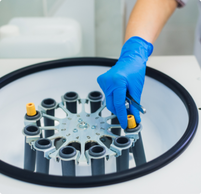 Plasma riche en plaquettes : qu’est-ce que la technique PRP et comment le rajeunissement ovarien peut-il vous aider ?