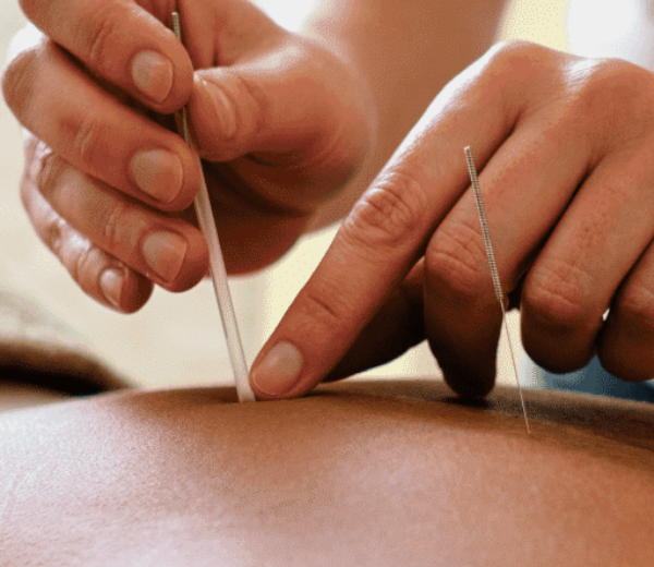 Unité d’endométriose et de chirurgie de la reproduction