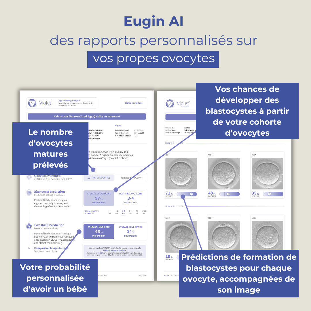 Eugin AI FR 2